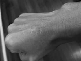 林昶佐成長階段時遭家暴傷痕（圖／林昶佐臉書）