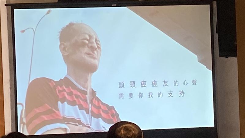 掉牙竟頭頸癌！他撐過「30次化療」