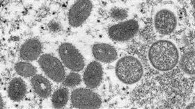 一項目前為止針對猴痘所做規模最大的研究發現，猴痘患者中有95%的人是經由性行為被傳染。圖為猴痘病毒粒子。（圖／翻攝自美國疾管署網頁cdc.gov）