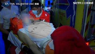男團舞者遭砸頭送ICU　曝最新傷勢