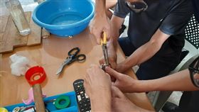 台南,戒指,中指,壞死,脫除,破壞