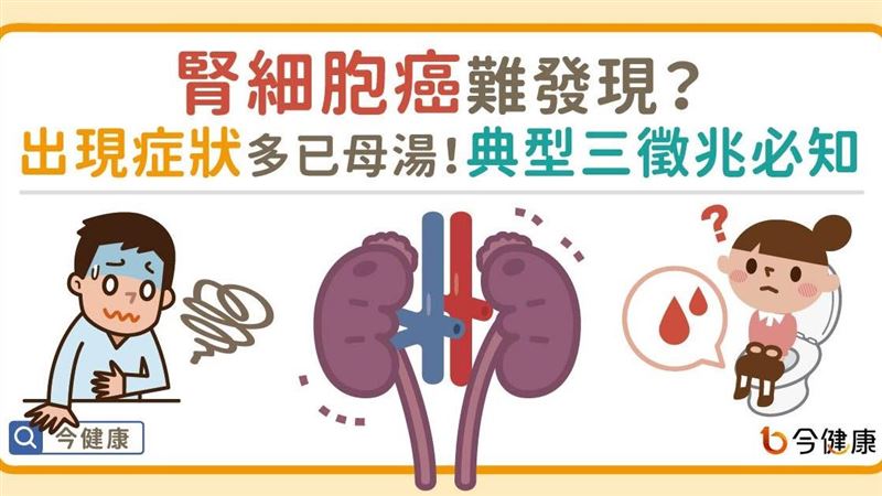 腎細胞癌難發現？出現症狀多已母湯！