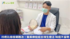 名家專用／鄭亷彥醫師坦言，凹疤的治療通常需要多次療程，因此患者大多會選擇透過PLT加強再生效果。(勿用)