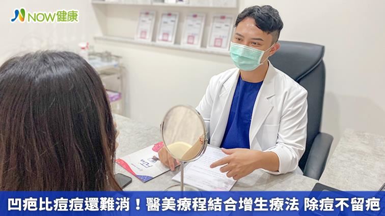 醫美療程結合增生療法！除痘不留疤