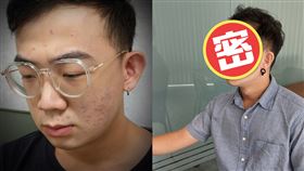 讓前女友後悔！痘花臉宅男靠台酒「退痘」對比超驚人