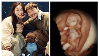 KID曝試管求子心酸　認蠻多問題的