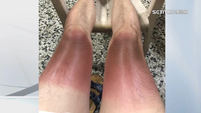 穿短袖褲騎車闖南橫　男曬成3層色