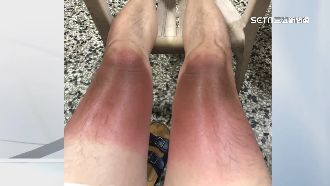 穿短袖褲騎車闖南橫　男曬成3層色