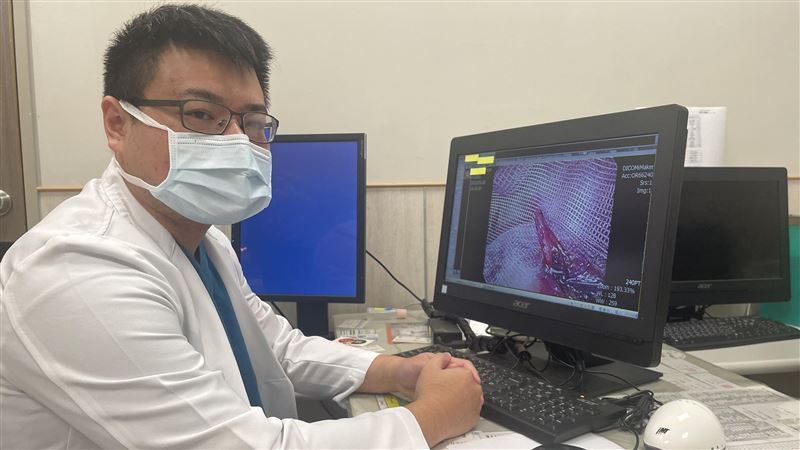 運動教練腹痛　才知腸子掉到腹股溝