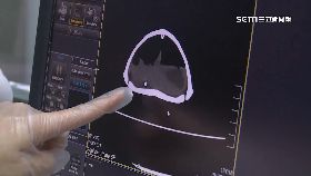 A斷層照蛇龜1200