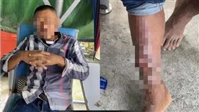 台中33歲林姓男子，柬埔寨，詐騙集團丟包西港街頭，右小腿傷口潰瀾見骨 (圖／民眾提供)