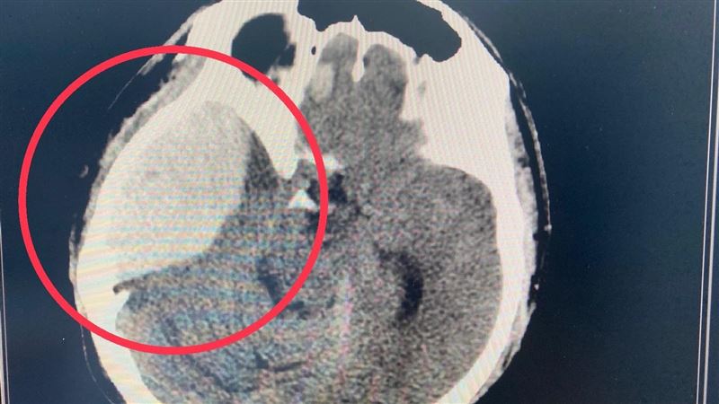 年輕移工「混酒狂歡」　隔天竟叫不醒