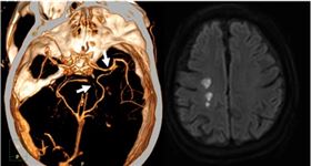 台中榮總（圖／翻攝畫面）