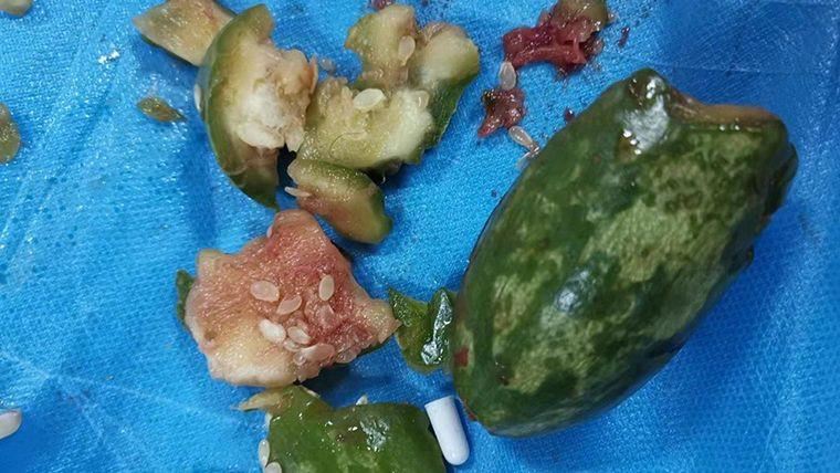 他洗菜滑倒菜瓜滑進肛　網秒懂笑了