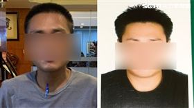 台男遭退貨丟西港流浪，腳挖洞潰爛打斷牙，3個月瞬間蒼老30歲，判若兩人(圖／家屬提供)