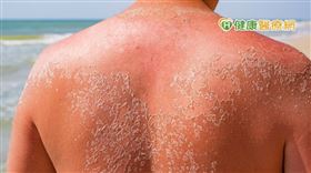 曾涵琪醫師表示，有名乾癬患者到墾丁戲水時，被太陽曬傷，受傷的皮膚恢復後長出一塊塊乾癬新病灶，身邊的人誤會是某種可怕的傳染病而不敢靠近他，令他感到困擾、挫折，所幸接受藥物治療、勤擦防曬、妥善保養後，目前病情已經穩定下來。