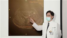 新光醫院神經外科主任蔡明成。（圖／新光醫院提供）