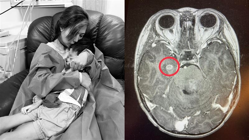 網紅兒腦癌過世　歪頭嘔吐前期徵兆曝