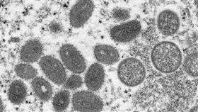 一項目前為止針對猴痘所做規模最大的研究發現，猴痘患者中有95%的人是經由性行為被傳染。圖為猴痘病毒粒子。（圖／翻攝自美國疾管署網頁cdc.gov）