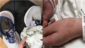 女大生遭閃電擊中胸口。（圖／翻攝自Erin Eggler 臉書）