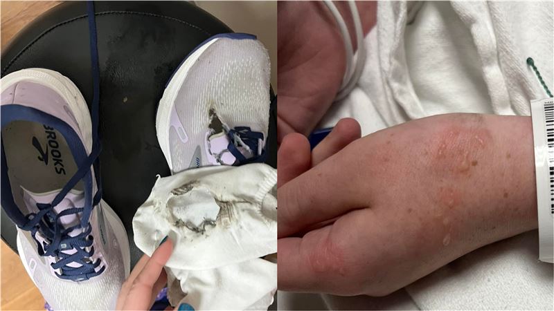 女大生慘遭閃電擊中胸部　媽媽曝現況