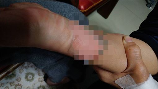 不是中邪！5旬男遭刺傷突痙攣險死竟1疾病