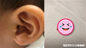 其他稿件請勿使用，謝謝！幼童耳屎／家屬提供
