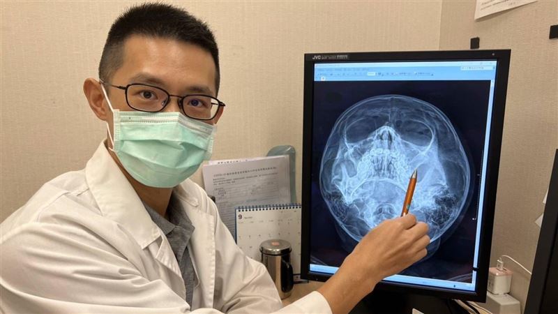 童突發燒、流黃膿鼻涕　鼻竇炎上身