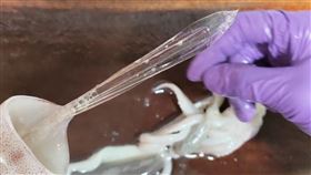 7旬翁小腸被透抽的透明骨骼刺穿。（示意圖／許家榮醫師提供）