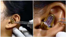 整隻蛇卡在耳朵！醫拿鑷子狂戳　牠「張嘴竄動」抵死不從（圖／翻數字Chandan Singh FB）