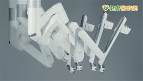 達文西機械手臂，可說是「進階版的腹腔鏡」，由醫師遠端操控機械手臂，一樣透過幾個小傷口伸入器械，在患者體內進行手術。