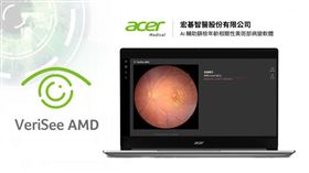 ▲宏碁智醫「黃斑部病變」AI篩檢獲智慧醫材許可。（圖／宏碁智醫提供）