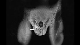 恩主公醫院提供、翻攝自pixabay