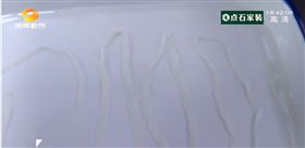 毛炸！女身體竟藏4米線蟲　驚悚飲食習慣曝（圖／翻攝自微博）