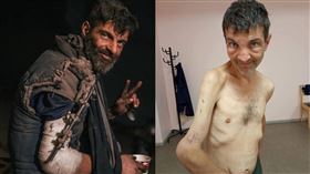 亞速鋼鐵廠，迪安諾夫（Mykhailo Dianov），被俘獲釋，身形消瘦，斷手彎曲變形，少4公分，募款醫藥費，24小時達1.6億台幣(合成圖／翻攝自烏克蘭國防部推特)