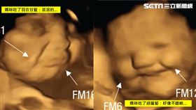 嬰兒超音波／翻攝自國際期刊《心理學》