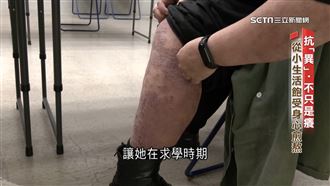 抗異之路不孤單！生物製劑放寬健保給付