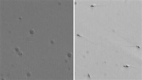 圓精細胞與精子比較圖。（圖／北榮提供）