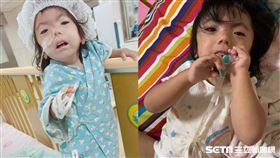 罕病女童宓宓／家屬提供