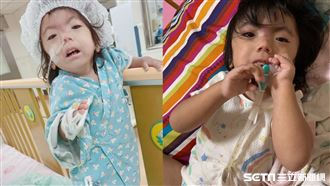 獨／罕病童造口缺醫材　母求救：幫幫我們