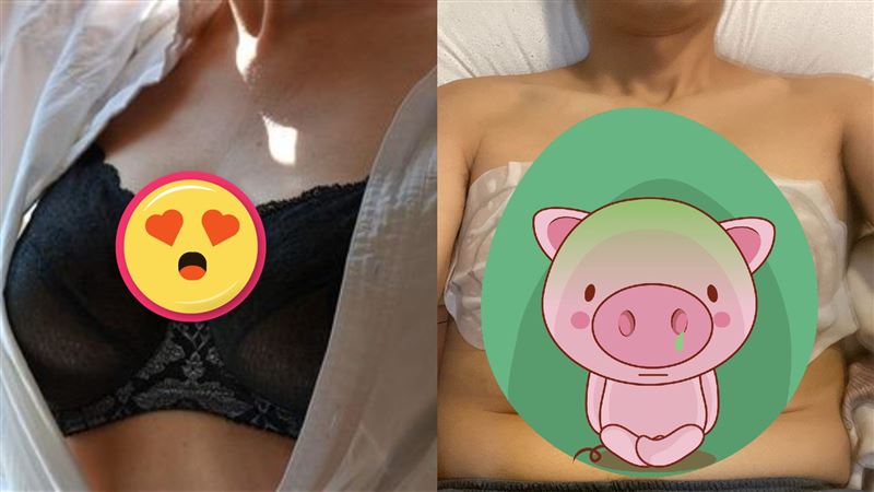 妻買「胸膜」稱能變大　他曬照網笑卡後續