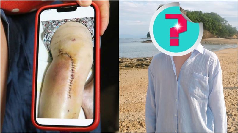 男星違停害女外送員骨裂：撞特斯拉還敢告