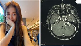 ▲陳筱蕾腦瘤復發治療一年後曝光現況。（圖／翻攝自陳筱蕾臉書）