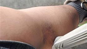 機車,騎士,瘀青,脛骨殺手,飛旋踏板https://www.facebook.com/photo?fbid=196536029413091&set=pcb.196536052746422