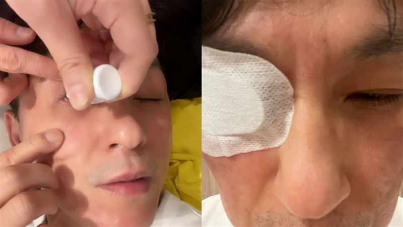 狄志為誤滴強效殺菌藥水　角膜灼傷送急診