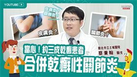 蔡秉翰醫師提醒，患者平常皮膚防曬與保濕工作要做好，同時要有足夠的睡眠才能避免免疫系統不正常活化，並保持樂觀心態，定期回診，才能維持良好生活品質。