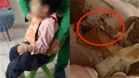 發燒,推拿,調理,兒童,蛆,中醫