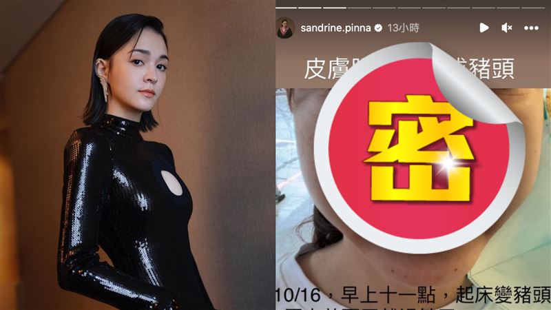 混血女星睡醒慘毀容　近照醜到不想見人