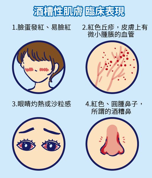 皮膚狀況傻傻分不清　保養不成反傷皮膚