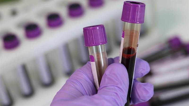 妙齡女發燒、疲倦確診愛滋　疫調一查嚇壞